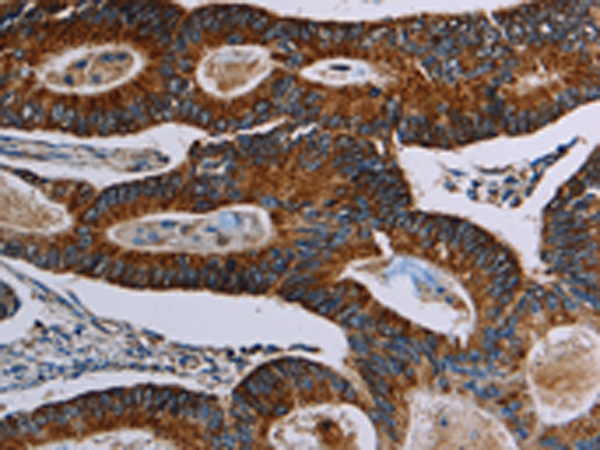 Rabbit Polyclonal Antibody to NDUFA4