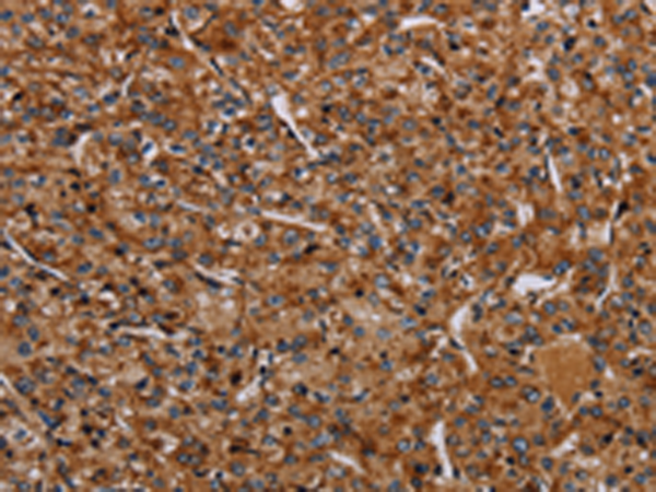 Rabbit Polyclonal Antibody to NDUFA8