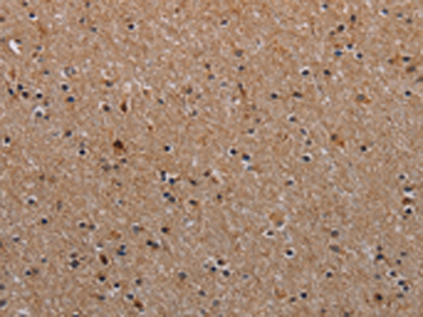 Rabbit Polyclonal Antibody to NDUFA8