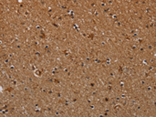 Rabbit Polyclonal Antibody to NDUFAB1