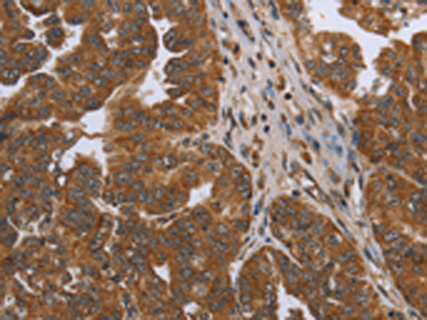 Rabbit Polyclonal Antibody to NDUFAF4