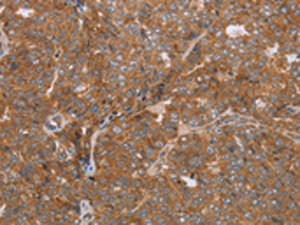 Rabbit Polyclonal Antibody to NDUFS2