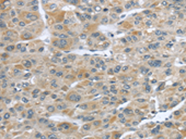 CFAP45