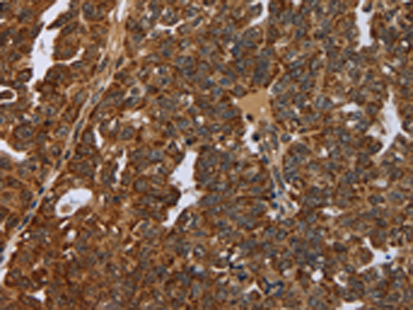Rabbit Polyclonal Antibody to NEFH