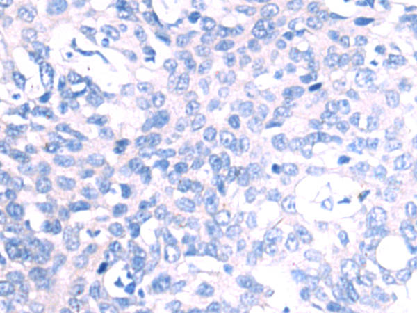 Rabbit Polyclonal Antibody to NEFM