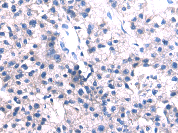 Rabbit Polyclonal Antibody to NEFM