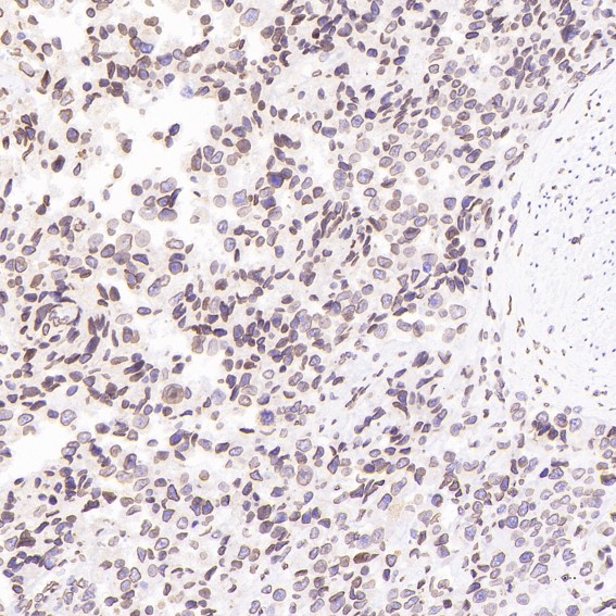 Rabbit Monoclonal to Lamin B1