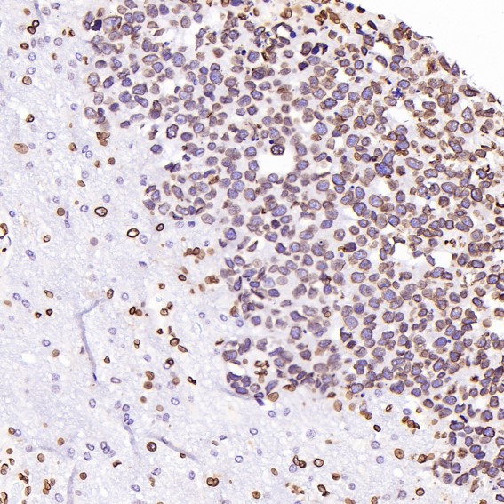 Rabbit Monoclonal to Lamin B1