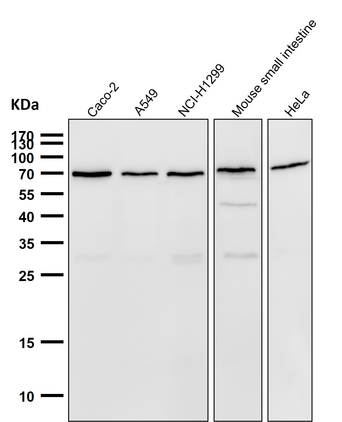 Rabbit Monoclonal to Lamin B1