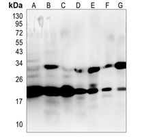 AKAP14