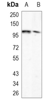 ARHGAP26