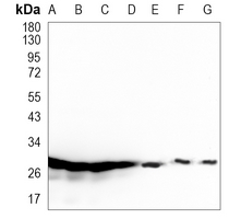 SNRPA1