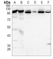 TNPO3