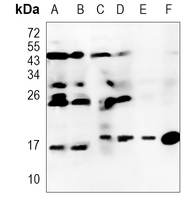 PFDN5