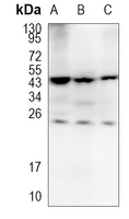 CSN1S1