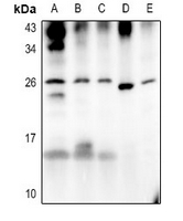 MT-ATP6