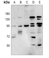 RFX3