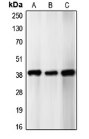CDK5R2