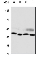 CCRL2