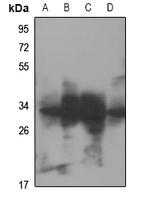 RNF144A