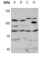 MPHOSPH10