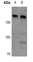 ARID4B