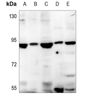 SLC6A15