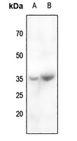 CABP4