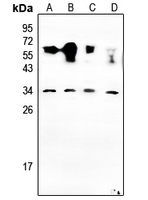 NRSN2