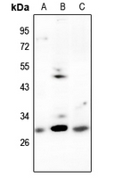 CDCA3