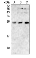 RGS17