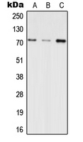 INPP5E