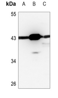 PSKH2