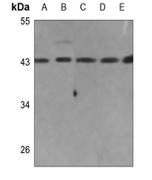 EMID2