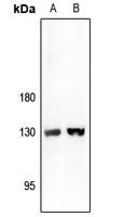 ARHGAP20