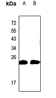 CABP2