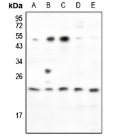 RND2