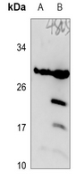 DHRS11