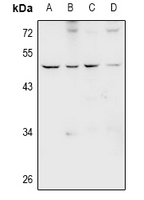 NMUR1