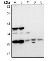 NRBF2