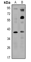 SLC30A8
