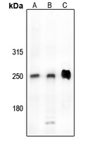CDK5RAP2