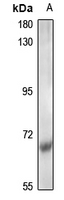 CDK5RAP1