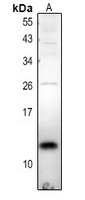 TCEAL7