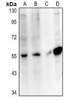 SLC10A4