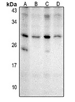 NKX2-8