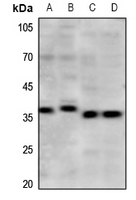 PAQR5