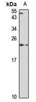 SAT1