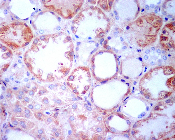Rabbit Monoclonal to TGFBI