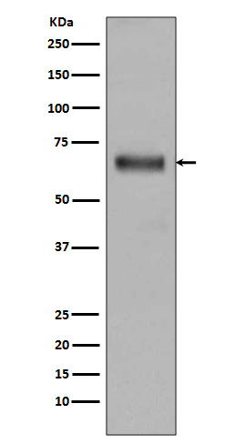 Rabbit Monoclonal to TGFBI